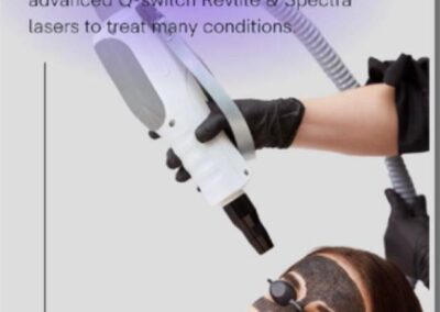 Laser Treatments IMG 20231108 WA0030